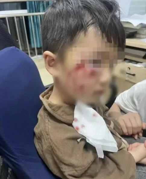 被瘋?cè)麤](méi)有“救命藥”，怎么辦？